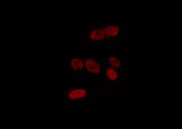 IKZF2 / HELIOS Antibody