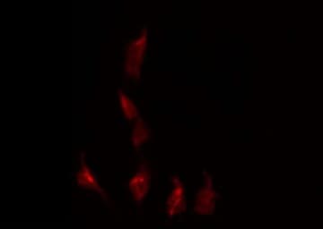 Polyclonal Rabbit anti-Human LGALS3 / Galectin 3 Antibody (IHC, IF, WB)