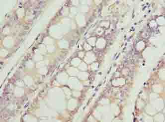 VPS45 Antibody