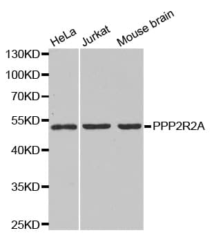 PPP2R2A Antibody