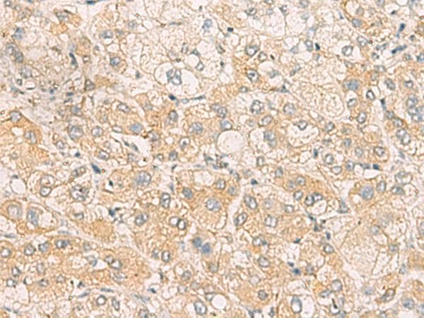 Polyclonal Rabbit anti-Human SYNGR1 / Synaptogyrin 1 Antibody (IHC)