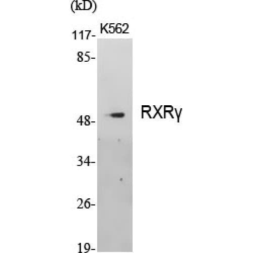 Polyclonal Rabbit anti-Human RXRG Antibody (140-220 aa, Internal, IHC, IF, WB)