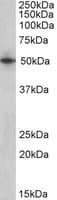 IHC-plus™ SEPT4 / Septin 4 Antibody (aa440-450)