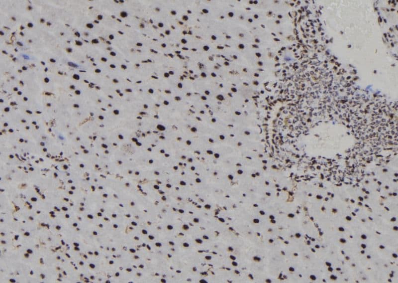 Polyclonal Rabbit anti-Human H3F3B Antibody (IHC, WB)