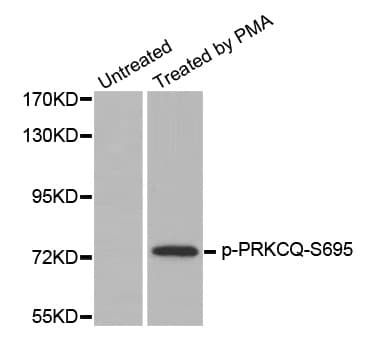 PRKCQ / PKC-Theta Antibody (phospho-Ser695)