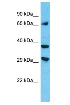 MAGEC3 Antibody (aa361-410)