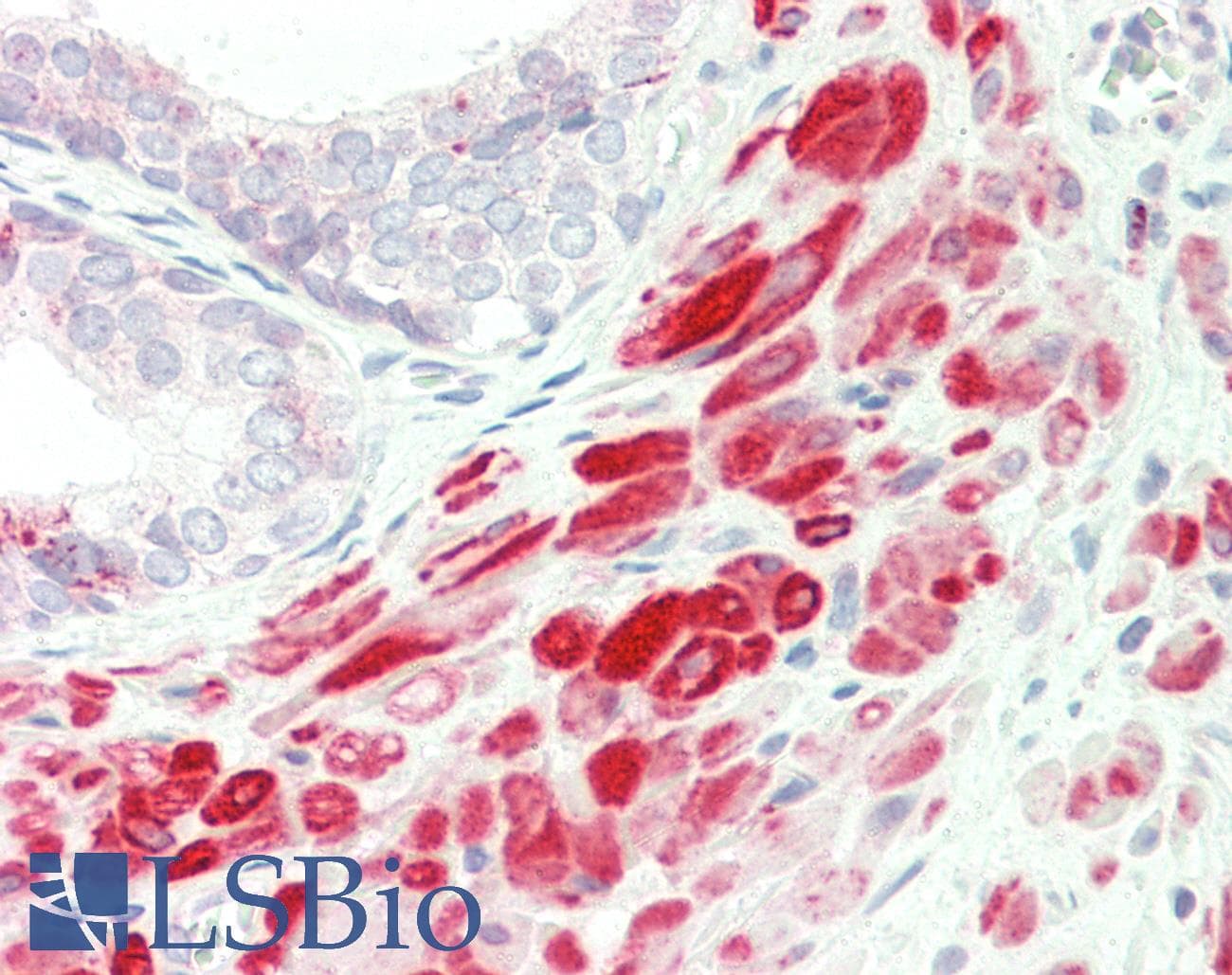 FLII / FLI Antibody (aa1116-1165)