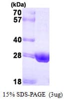 Human HSD17B10 / HADH2 Protein (Recombinant His)