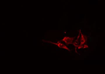 GBA3 / CBG Antibody
