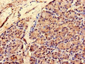 RCOR3 Antibody