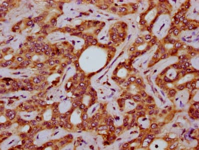 SLC15A4 / PHT1 Antibody