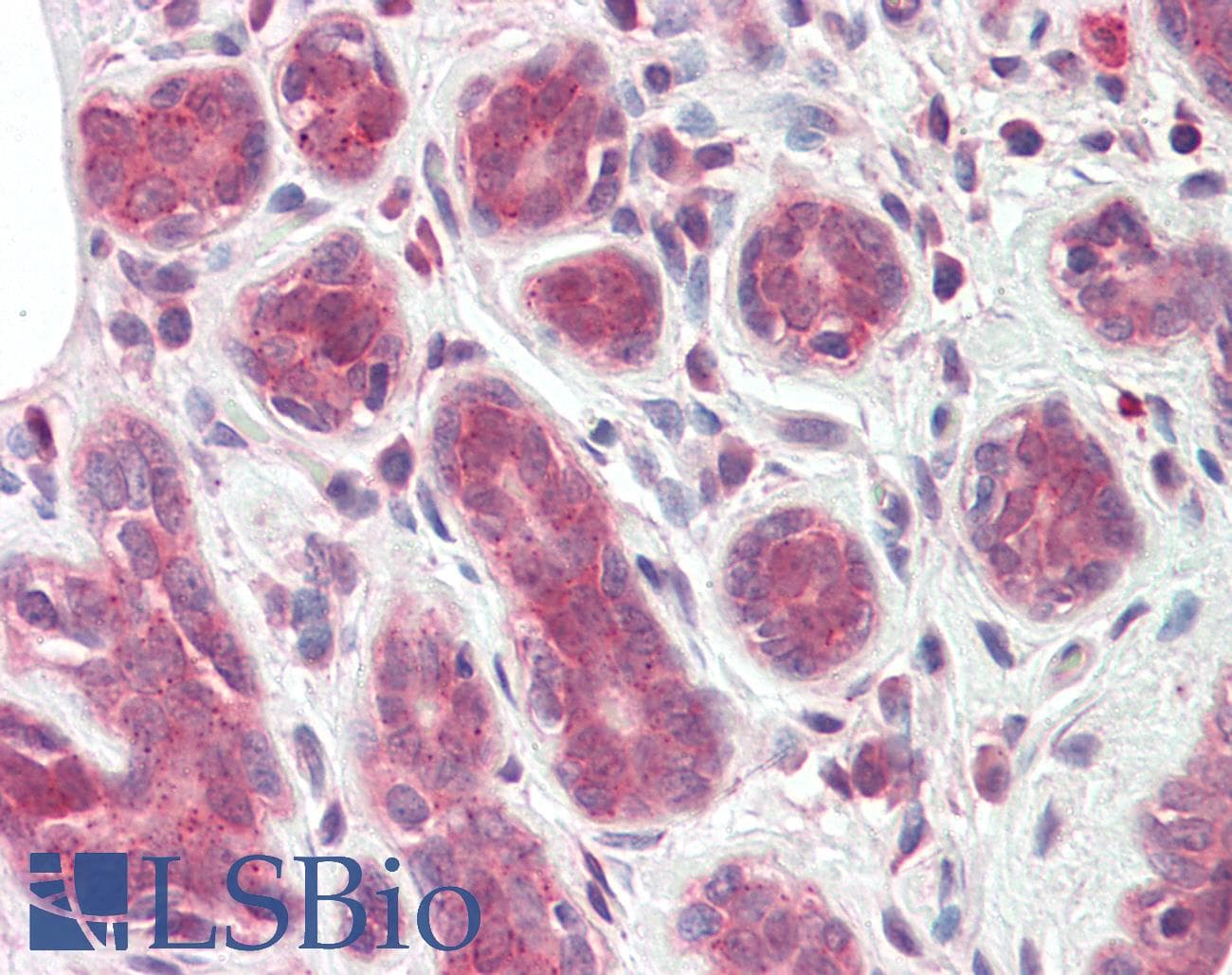 IHC-plus™ Polyclonal Goat anti-Human TIPRL / TIP Antibody (aa257-270, IHC, WB)