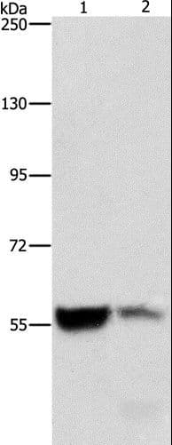 ALDH8A1 Antibody