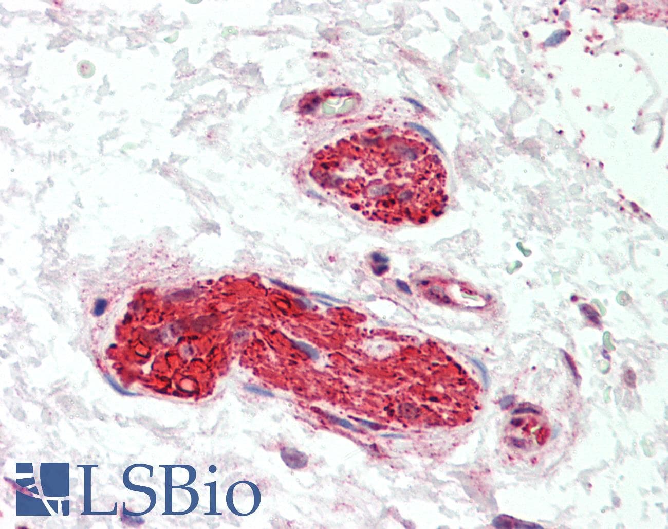 IHC-plus™ LMTK3 Antibody (aa1251-1300)