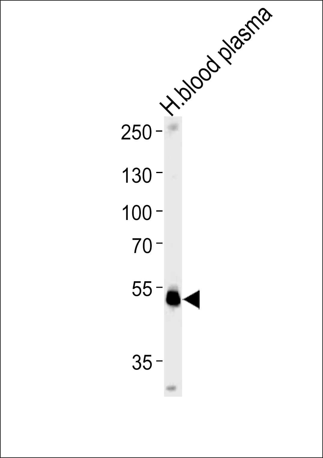 Polyclonal Rabbit anti-Human SERPINF1 / PEDF Antibody (aa279-306, IHC, WB)
