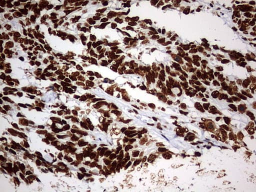 Monoclonal Mouse anti-Human HNRPM / HNRNPM Antibody (clone OTI1F6, aa1-261, IHC, WB)
