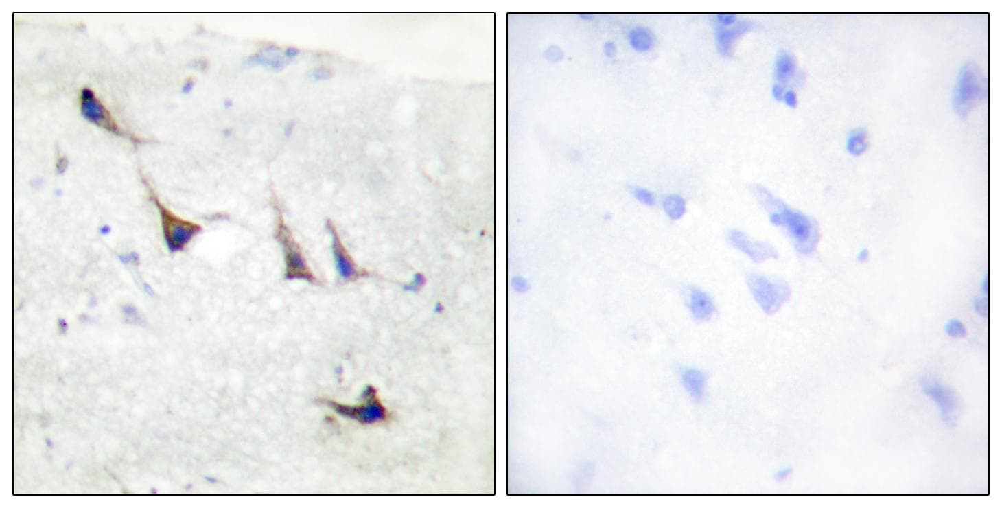 STX1A / Syntaxin 1A Antibody (p14)
