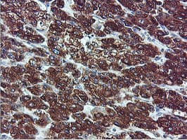 ILVBL Antibody (clone OTI8B12)