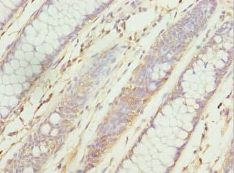 ZNF169 Antibody