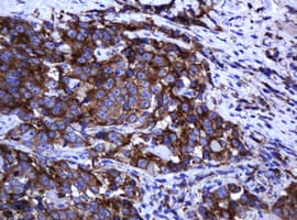 ARMC1 Antibody (clone OTI2E5)