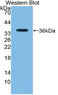 NT5C3A Antibody (aa52-336)