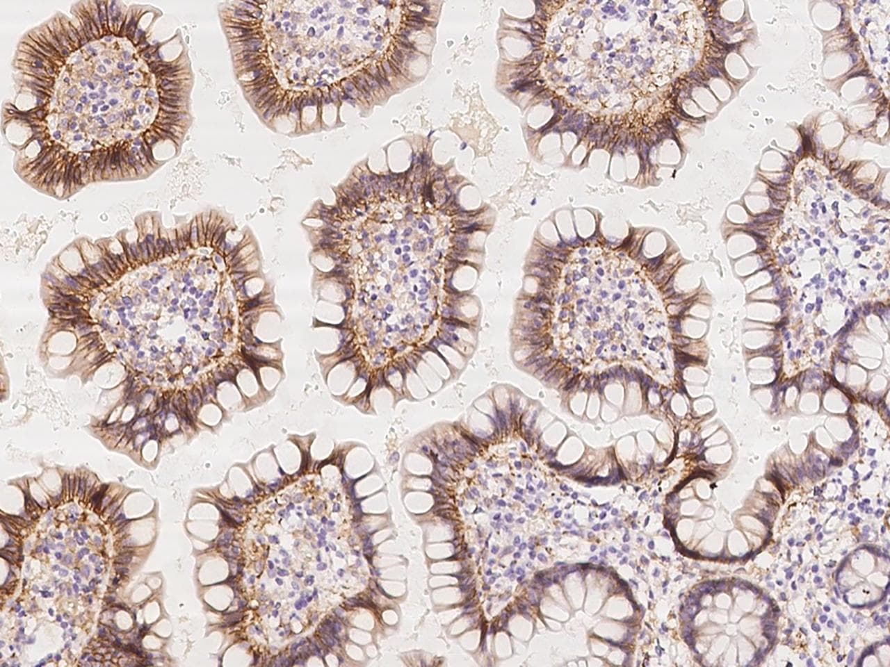 Polyclonal Rabbit anti-Human EPB41L3 Antibody (IHC)