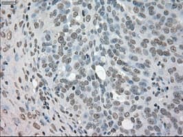 NEK6 Antibody (clone OTI5D7)