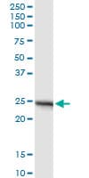Monoclonal Mouse anti-Human APOA1 / Apolipoprotein A 1 Antibody (clone 3A11-1A9, WB)