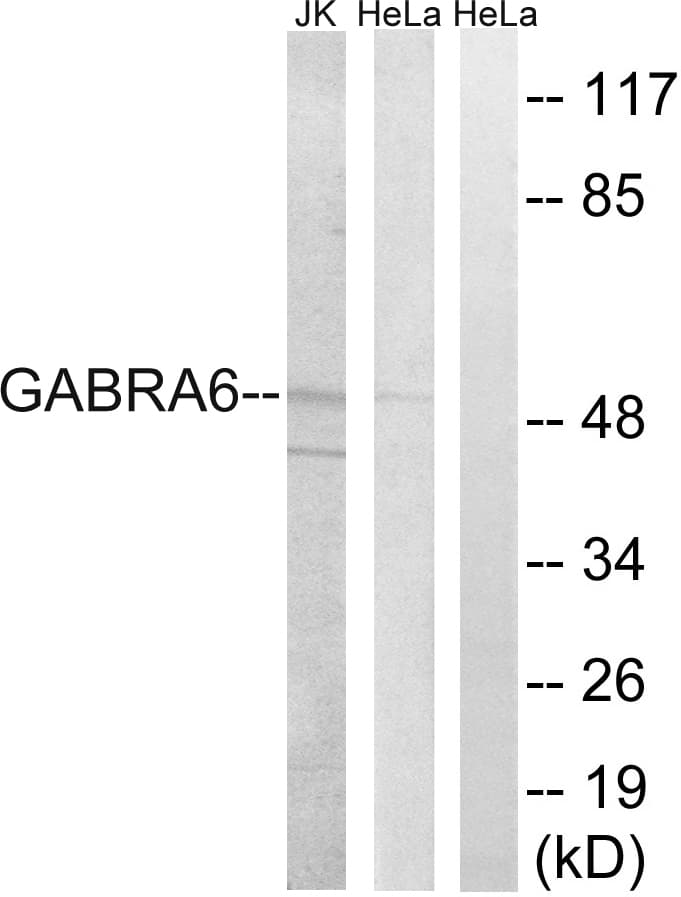 GABRA6 Antibody (aa61-110)