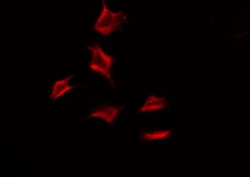 CDw218a / IL18R1 Antibody