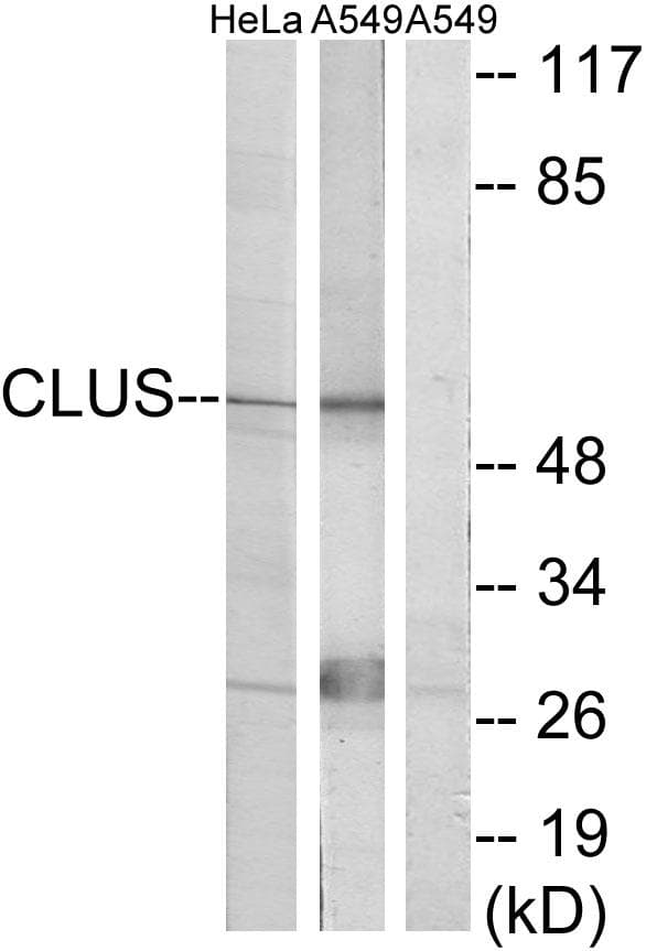 Polyclonal Rabbit anti-Human CLU / Clusterin Antibody (IHC, IF, WB)