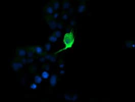 MDM4 / MDMX Antibody (clone OTI1D11)