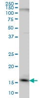 Monoclonal Mouse anti-Human C1D Antibody (clone 6H2, IF, WB)
