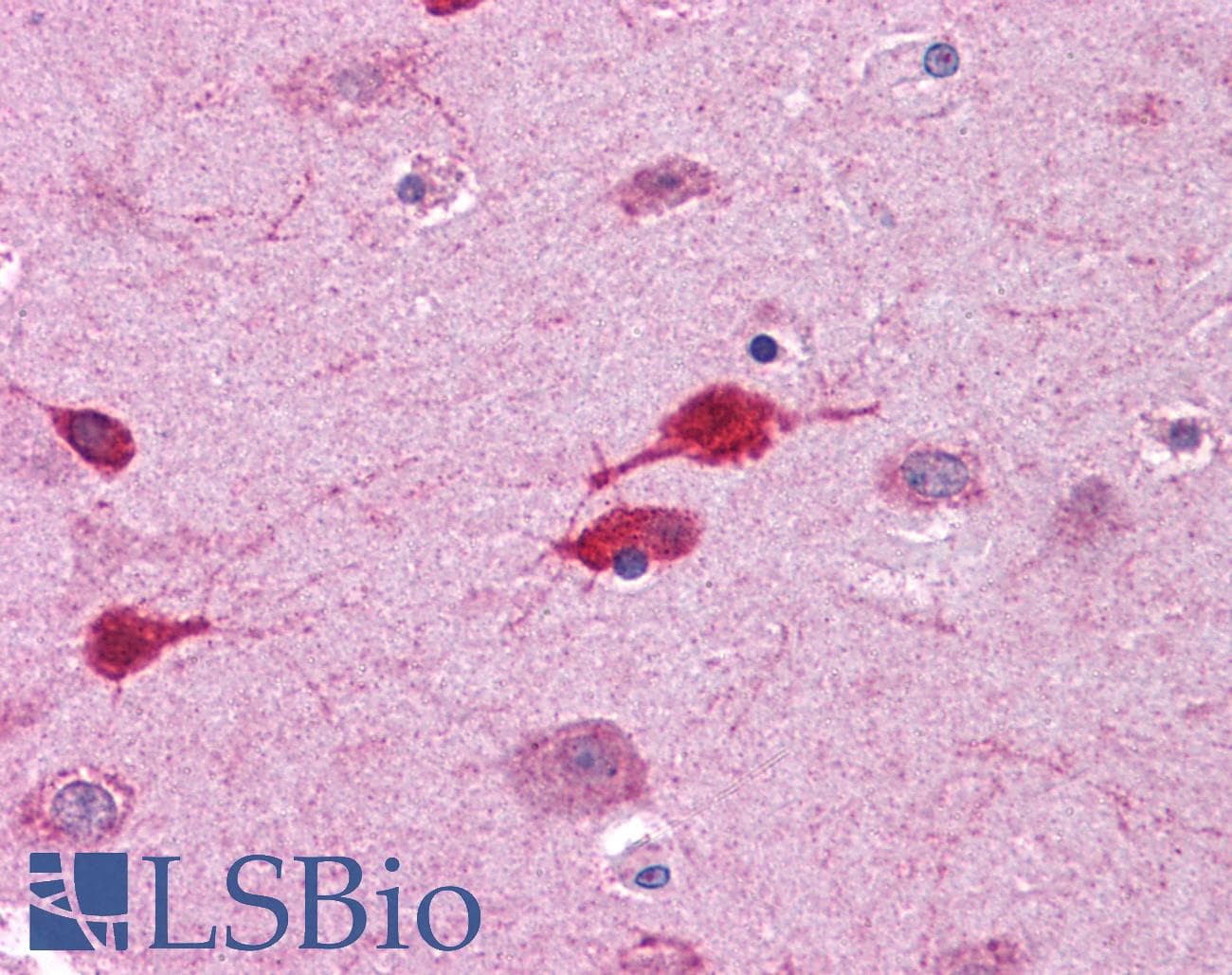 WNT5A Antibody (aa180-229)