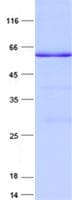 Human MCIDAS / MCIN Protein (Recombinant His, N-Terminal)