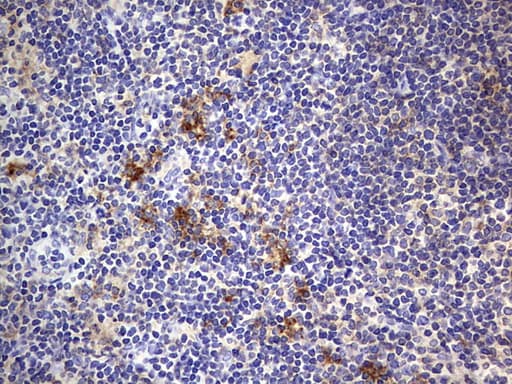 PathPlus™ B2M / Beta 2 Microglobulin Antibody (aa21-119, clone OTI1A7)
