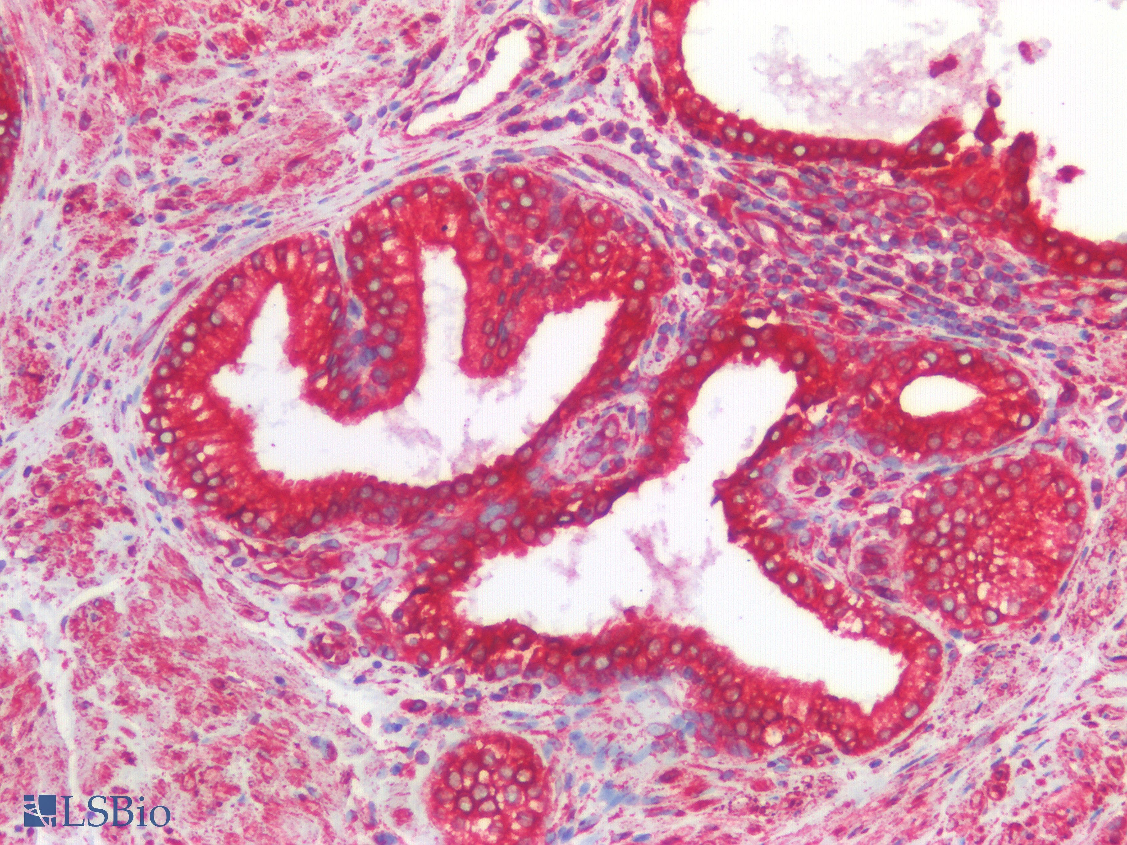 PathPlus™ CANX / Calnexin Antibody