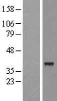SLC25A39 Protein (Over-Expression Lysate Myc-DDK (Flag))