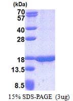 Human TUSC2 / FUS1 Protein (Recombinant His)