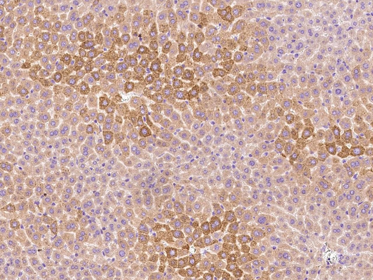 KIR3DL1 Antibody