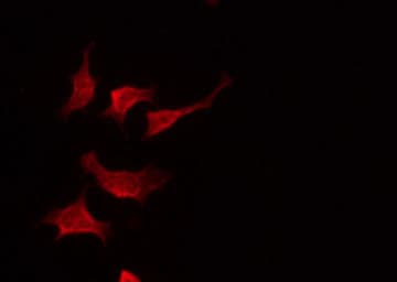 CLDN19 / Claudin 19 Antibody