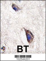 Polyclonal Rabbit anti-Human DKK3 Antibody (aa15-45, IHC, WB)
