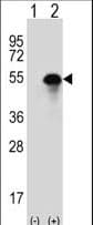 CA14 / Carbonic Anhydrase XIV Antibody (aa51-80)