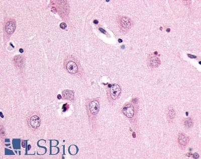 PathPlus™ SSTR3 Antibody (C-Terminus)