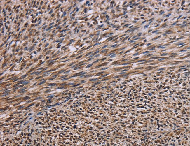 KIF2A Antibody
