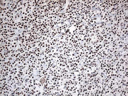 EWSR1 / EWS Antibody (aa256-447, clone OTI3F6, Carrier-free)
