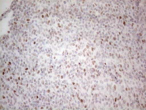HDAC2 Antibody (aa415-488, clone OTI7E10)