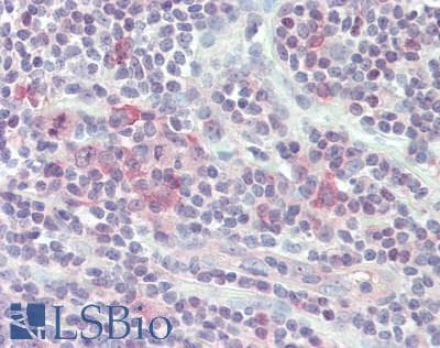 KLRC1 / NKG2A / CD159a Antibody (aa1-30)