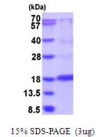 Rat VEGFA / VEGF Protein (Recombinant His)