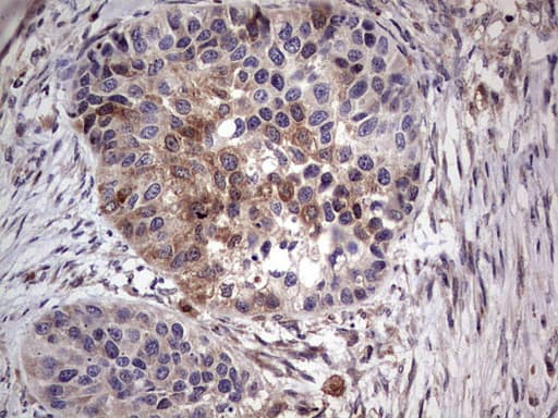 Monoclonal Mouse anti-Human PKM2 Antibody (clone 11B11, IHC, WB)